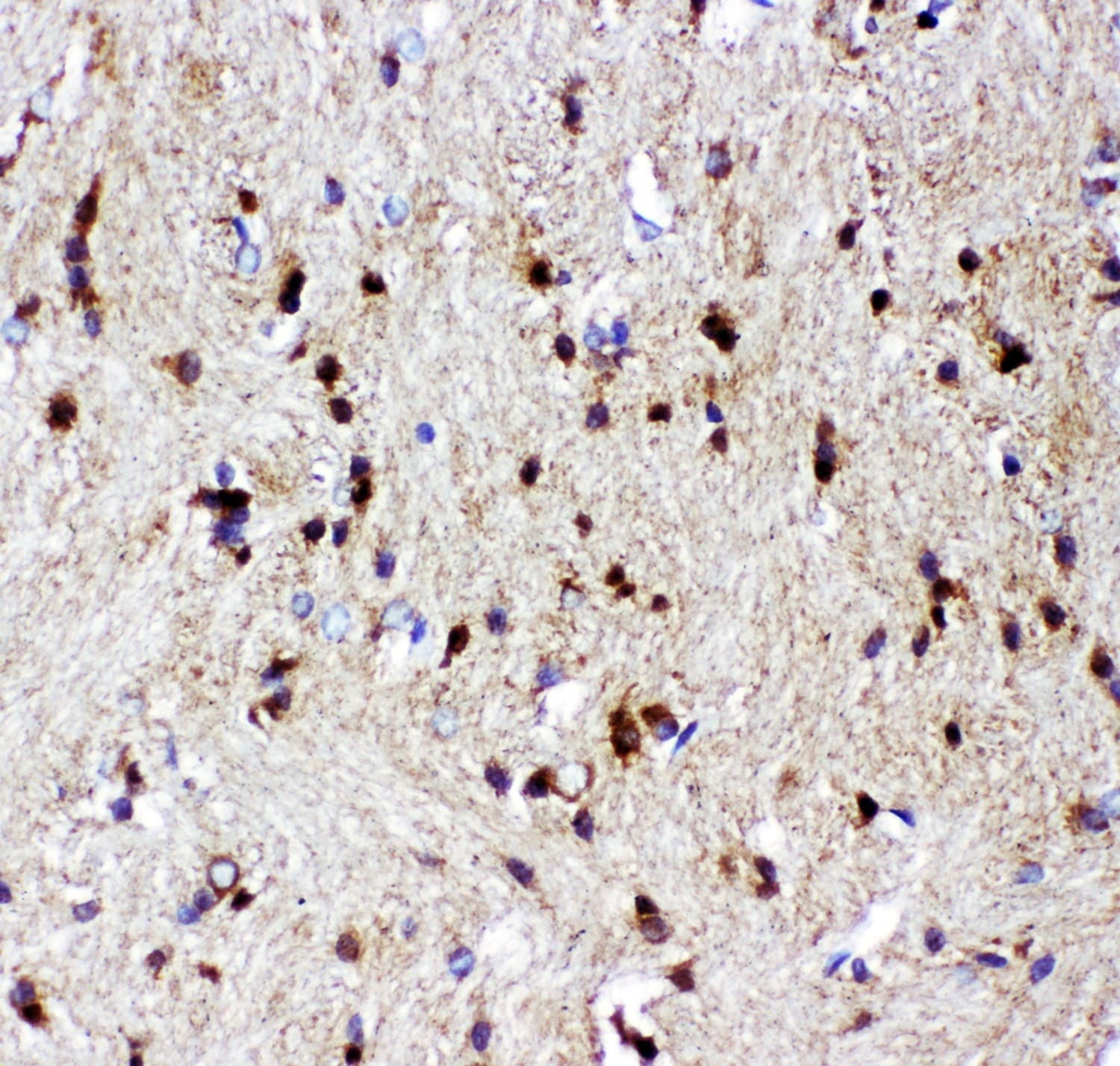 Polyclonal Rabbit anti-Human TP73 / p73 Antibody (aa1-198, IHC, WB)