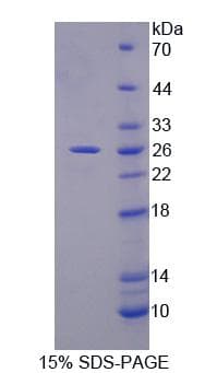 Mouse PLCL1 Protein (Recombinant)