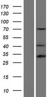 Human HOXD13 Protein (Over-Expression Lysate Myc-DDK (Flag))