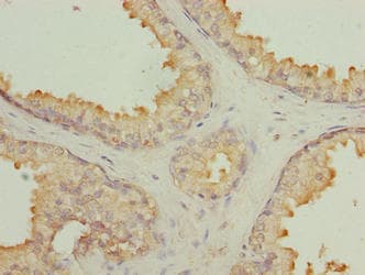 Polyclonal Rabbit anti-Human GLB1L2 Antibody (IHC)