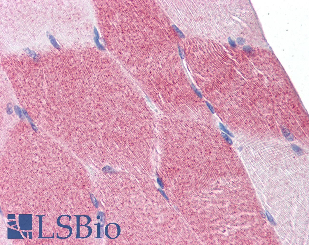 IHC-plus™ DAP-5 / EIF4G2 Antibody