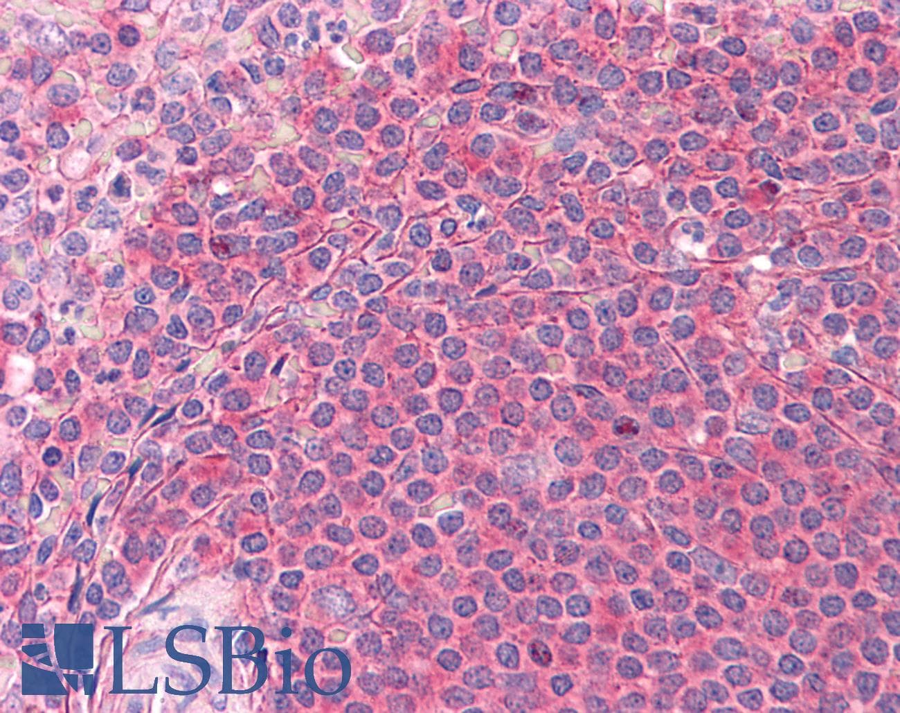 IHC-plus™ SH3GLB1 / Bif / Endophilin B1 Antibody (clone 1B3-A5)