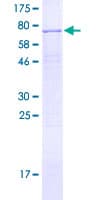Human PAPD5 Protein (Recombinant GST)