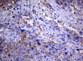 PIK3C2A Antibody (aa230-560, clone OTI1B8)