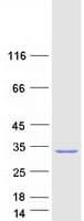 Human ENDOV Protein (Recombinant Myc-DDK (Flag))