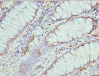 CMPK / CMPK1 Antibody