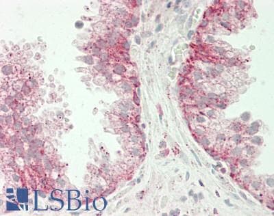 Polyclonal Rabbit anti-Human MECOM / EVI1 Antibody (aa964-1013, IHC, WB)
