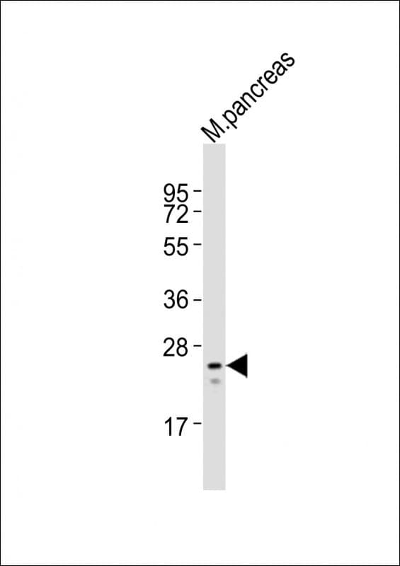 Polyclonal Rabbit anti-Mouse MESP1 Antibody (aa138-173, WB)
