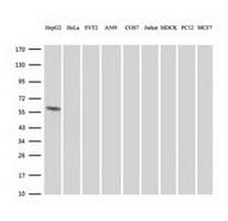 FTCD / 58K Golgi Protein Antibody (clone OTI4A7, Carrier-free)