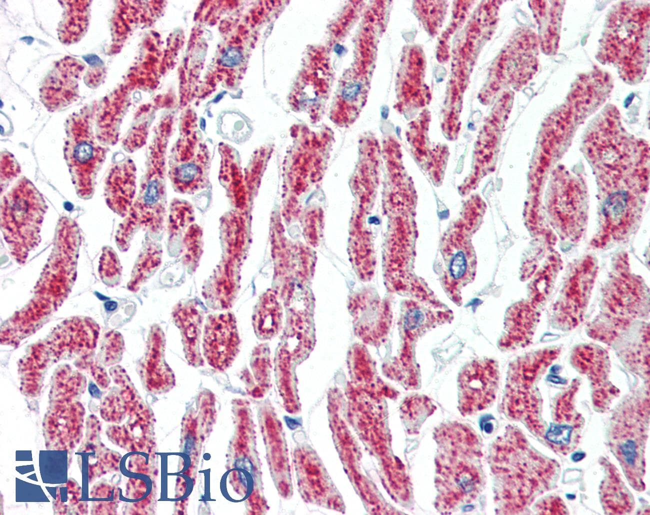 IHC-plus™ ACO2 / Aconitase 2 Antibody (aa438-467)