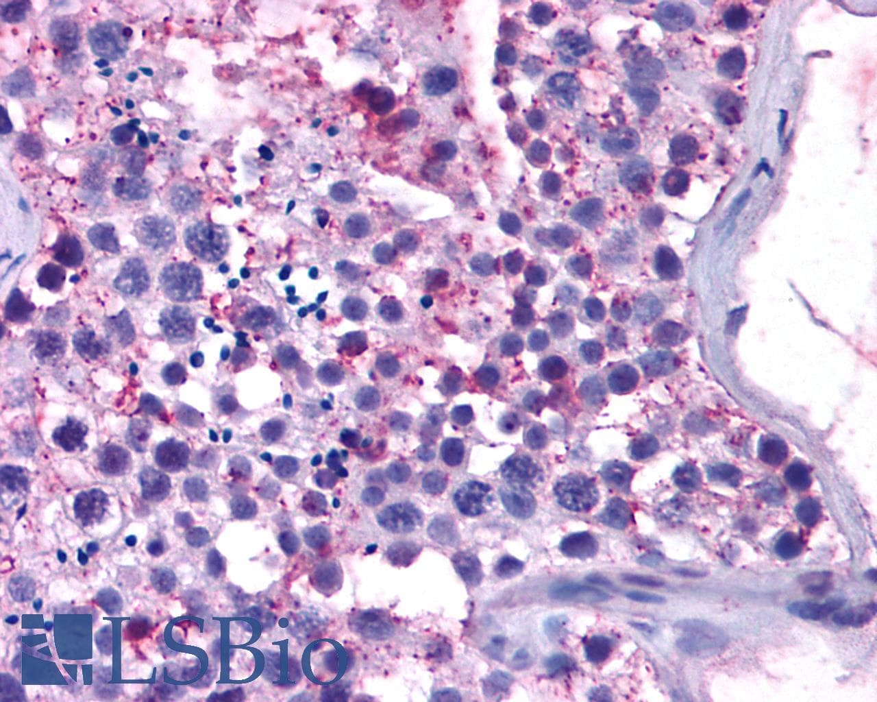 PathPlus™ Polyclonal Rabbit anti-Human MAS1 / MAS Antibody (C-Terminus, IHC)