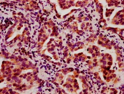 Polyclonal Rabbit anti-Human HIST1H2BN Antibody (IHC, IF)