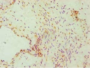 FKBP4 / FKBP52 Antibody (aa220-459)