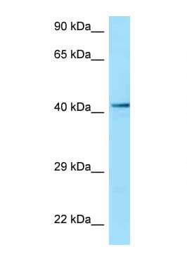 Polyclonal Rabbit anti-Human P2RY2 / P2Y2 Antibody (C-Terminus, WB)