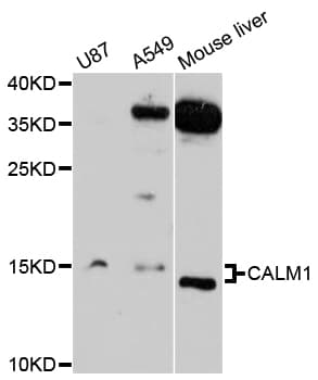 Polyclonal Rabbit anti-Human CALM1 / Calmodulin Antibody (IHC, WB)