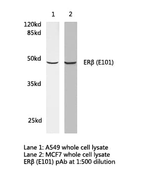 ESR2 / ER Beta Antibody (Glu101)