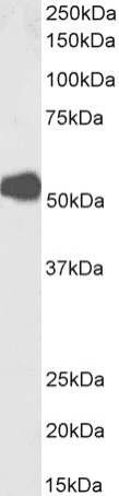 Recombinant Monoclonal Rat anti-Human CHRNA1 Antibody (clone mAb 192, Human Muscle Acetylcholine Receptor, WB)