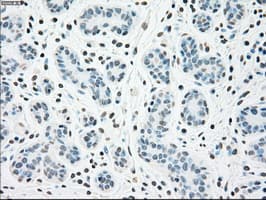 CHEK2 / CHK2 Antibody (clone OTI5C4)