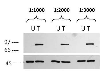 RPS6KA1 / RSK1 Antibody (phospho-Ser732)
