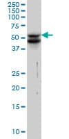 Vimentin Antibody (clone 3E9)