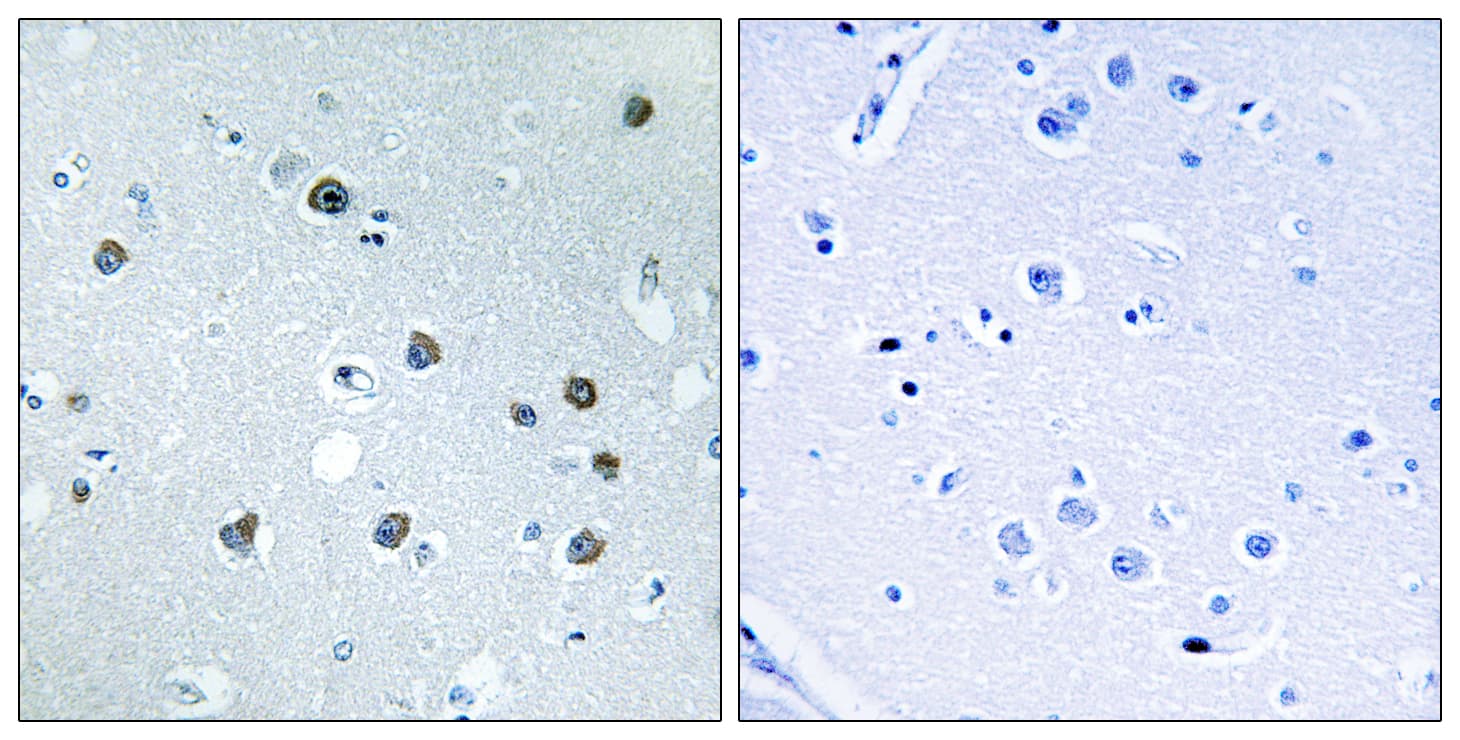 MYO1D Antibody (aa825-874)