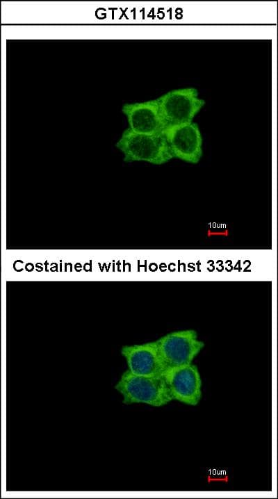 LAD1 Antibody (aa300-517)