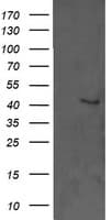 Monoclonal Mouse anti-Human MAPK3 / ERK1 Antibody (clone OTI4D7, IHC, IF, WB)