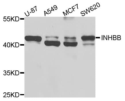 IHC-plus™ INHBB / Inhibin Beta B Antibody