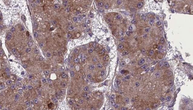 OR52R1 Antibody