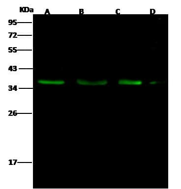 Polyclonal Rabbit anti-Human BIK Antibody (Preservative Free, IF, WB)