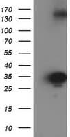 SULT1C2 / Sulfotransferase 1C2 Antibody (clone OTI4G1)