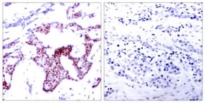 Polyclonal Rabbit anti-Human RELA / NFKB p65 Antibody (phospho-Ser276, IHC, WB)