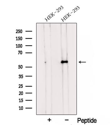 TMEM175 / MGC4618 Antibody