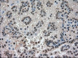 CTAG1B / NY-ESO-1 Antibody (clone OTI3C9)