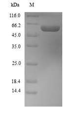 Mouse ALDH1A1 / ALDH1 Protein (Recombinant 6His, N-terminus)