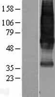SSTR1 Protein (Over-Expression Lysate Myc-DDK (Flag))