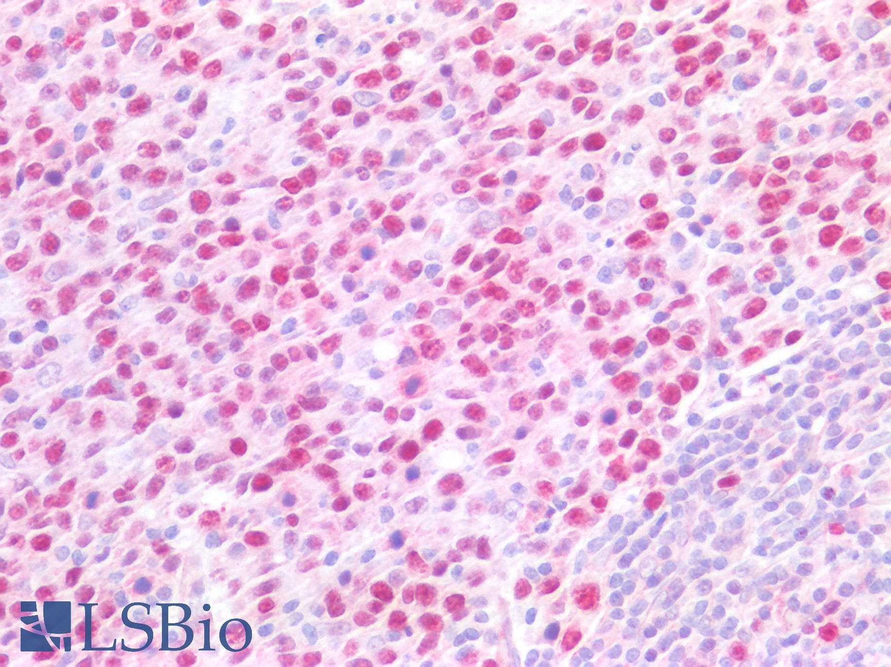 PathPlus™ MCM5 Antibody