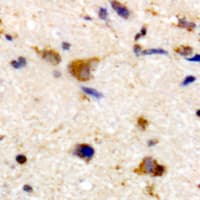 RCS / ARPP-21 Antibody (Internal)
