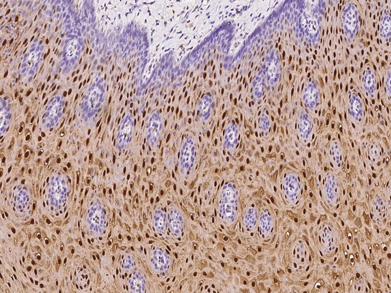 S100A8 / MRP8 Antibody