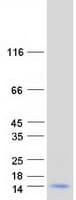 Human MT1H Protein (Recombinant Myc-DDK (Flag))