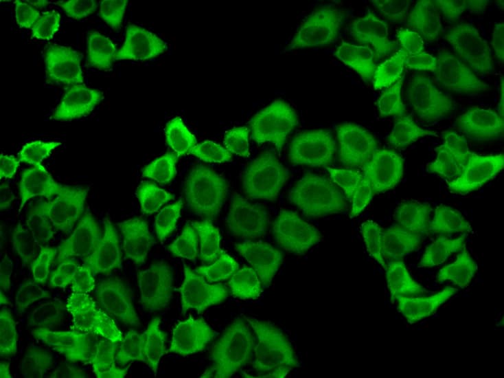 IHC-plus™ PRDX2 / Peroxiredoxin 2 Antibody