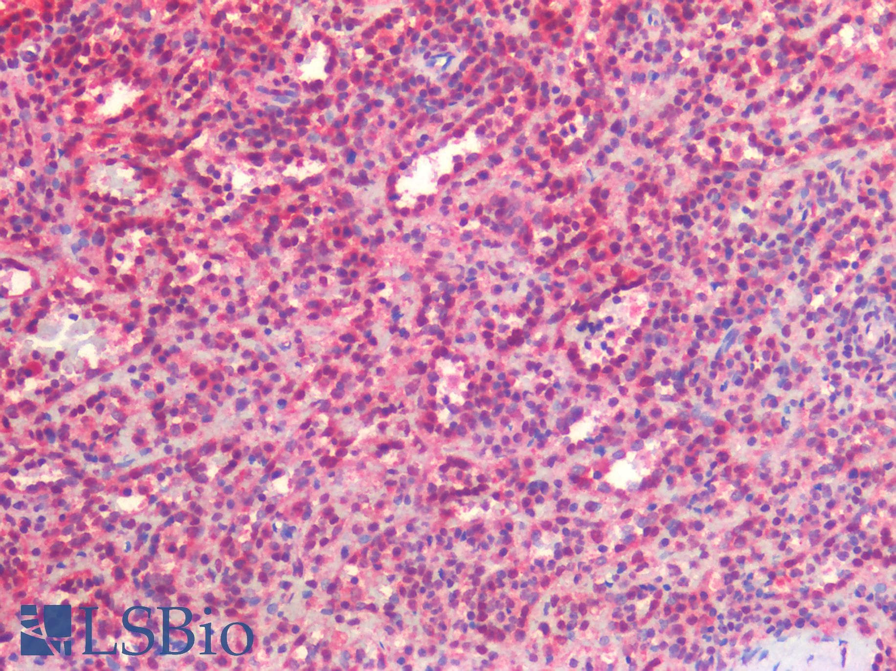 PathPlus™ Monoclonal Mouse anti-Human FOXP1 Antibody (clone JC12, IHC, WB)