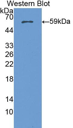 NUP188 Antibody (aa540-782)