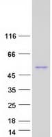 Human SNX7 Protein (Recombinant Myc-DDK (Flag))
