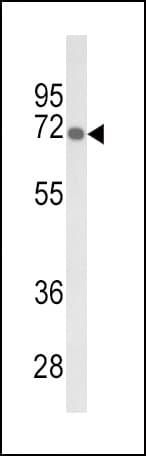 GBE1 Antibody (aa527-556)