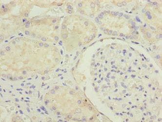 MED22 Antibody