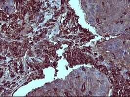 IHC-plus™ CD45 / LCA Antibody (clone 4C11)