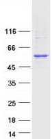 Human CYP4X1 Protein (Recombinant Myc-DDK (Flag))