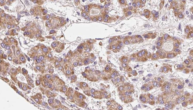 ADGRB3 / BAI3 Antibody
