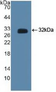 CTBP2 Antibody (aa1-252, APC)